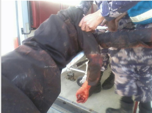 قتيل و 18 اصابة بمشاجرة جامعة الحسين ( صور )